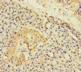 A4GNT Antibody