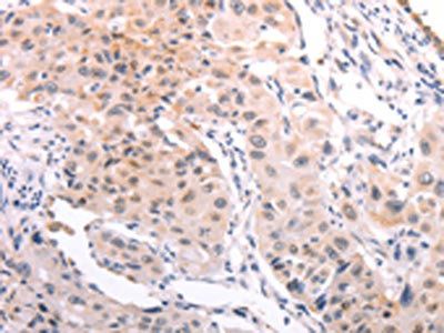 A4GNT Antibody