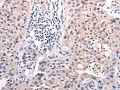 A4GNT Antibody