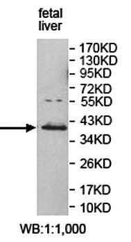 A4GNT Rabbit Polyclonal Antibody
