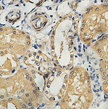 A4GNT Rabbit Polyclonal Antibody