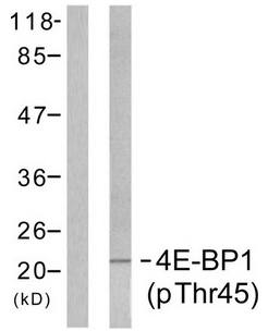 4E-BP1 (Phospho-Thr45) Antibody