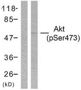 Akt (Phospho-Ser473) Antibody