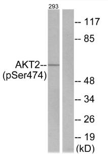 Akt2 (Phospho-Ser474) Antibody