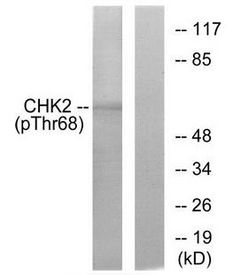 Chk2 (Phospho-Thr68) Antibody