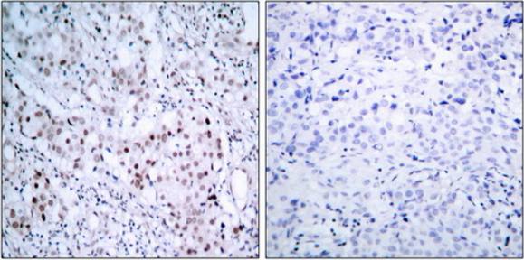 c-Jun (Phospho-Ser63) Antibody