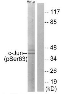 c-Jun (Phospho-Ser63) Antibody