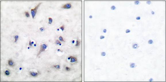 DARPP-32 (Phospho-Thr34) Antibody