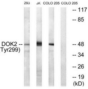 p56 Dok-2 (Phospho-Tyr299) Antibody