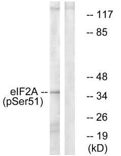 eIF2α (Phospho-Ser51) Antibody