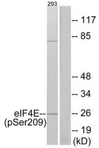 eIF4E (Phospho-Ser209) Antibody
