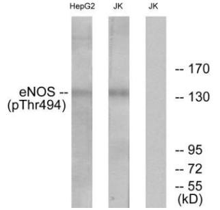 eNOS (Phospho-Thr494) Antibody
