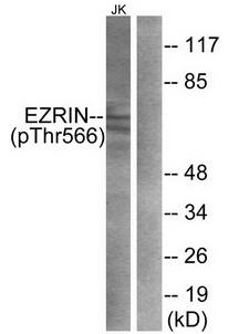 Ezrin (Phospho-Thr567) Antibody