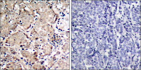 FKHR (Phospho-Ser319) Antibody