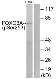 FKHRL1 (Phospho-Ser253) Antibody