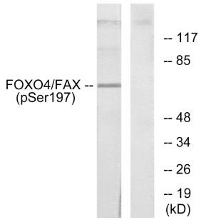 AFX (Phospho-Ser197) Antibody