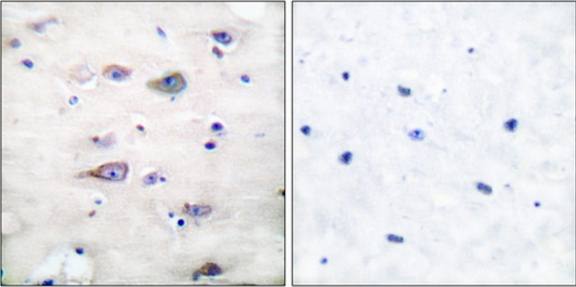 GluR2 (Phospho-Ser880) Antibody