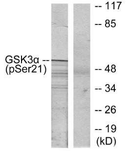 GSK3α (Phospho-Ser21) Antibody