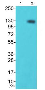 HDAC4 (Phospho-Ser632) Antibody