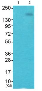 HER2 (Phospho-Tyr1248) Antibody