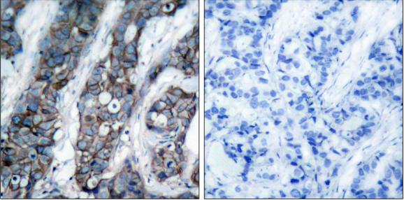 HER2 (Phospho-Tyr1248) Antibody