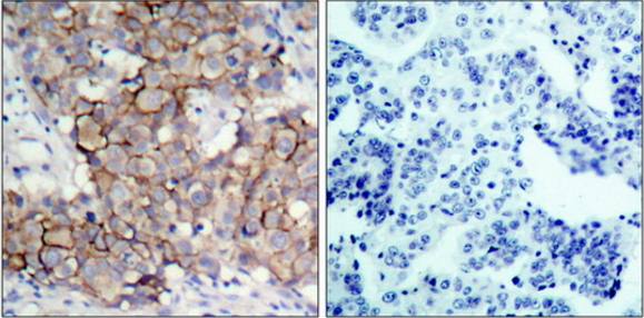 HER2 (Phospho-Tyr877) Antibody