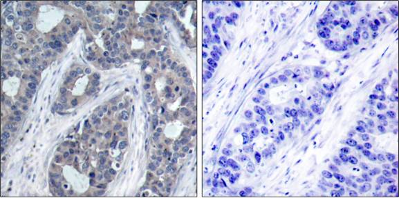 IRS-1 (Phospho-Ser636) Antibody