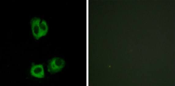 Lck (Phospho-Tyr394) Antibody