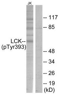 Lck (Phospho-Tyr394) Antibody
