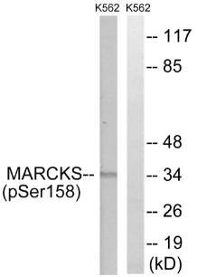 MARCKS (Phospho-Ser158) Antibody