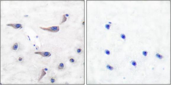 MARCKS (Phospho-Ser163) Antibody