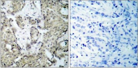 MKK3 (Phospho-Ser189) Antibody