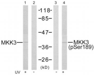 MKK3 (Phospho-Ser189) Antibody