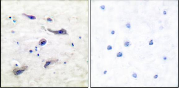 mTOR (Phospho-Ser2448) Antibody