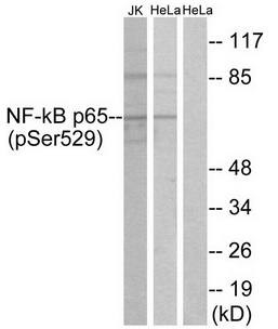 NF-κB p65 (Phospho-Ser529) Antibody