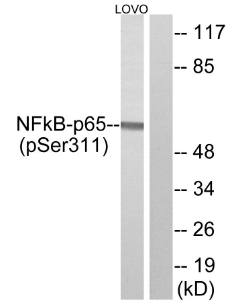 NF-κB p65 (Phospho-Ser311) Antibody