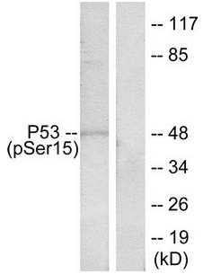 p53 (Phospho-Ser15) Antibody
