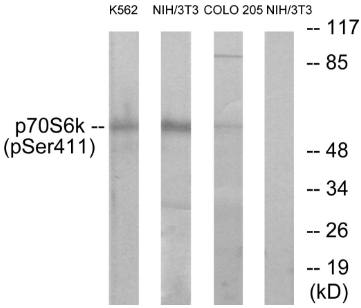 p70 S6 Kinase (Phospho-Ser411) Antibody
