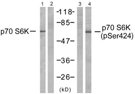 p70 S6 Kinase (Phospho-Ser424) Antibody