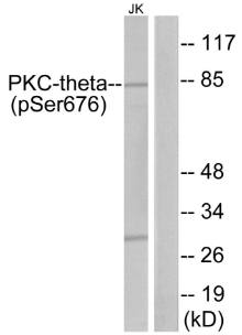 PKC θ (Phospho-Ser676) Antibody