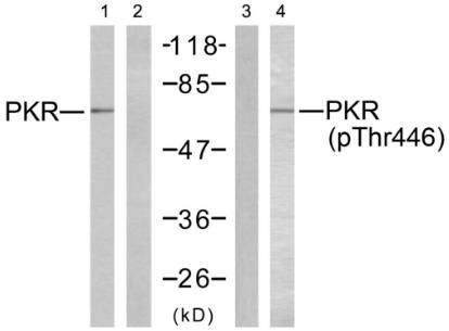PKR (Phospho-Thr446) Antibody