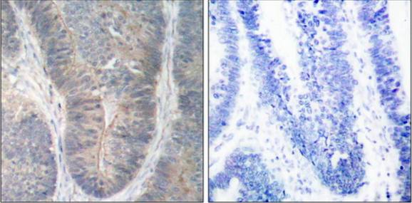 PKR (Phospho-Thr451) Antibody