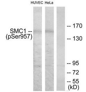 SMC1 (Phospho-Ser957) Antibody