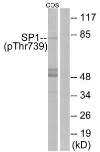 SP1 (Phospho-Thr739) Antibody