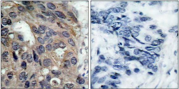 Src (Phospho-Tyr529) Antibody