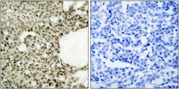 STAT1 (Phospho-Ser727) Antibody