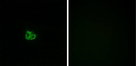 Stathmin 1 (Phospho-Ser15) Antibody