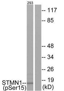 Stathmin 1 (Phospho-Ser15) Antibody