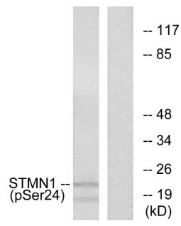 Stathmin 1 (Phospho-Ser24) Antibody