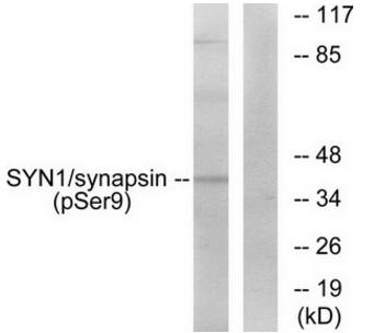 Synapsin (Phospho-Ser9) Antibody